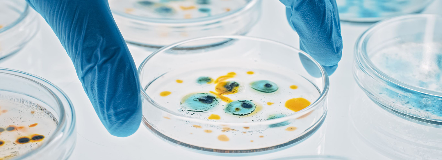 Revolutionizing Microbiological Analysis: ULTRA-TURRAX® Tube Drive with IVD Ball Mill Tubes