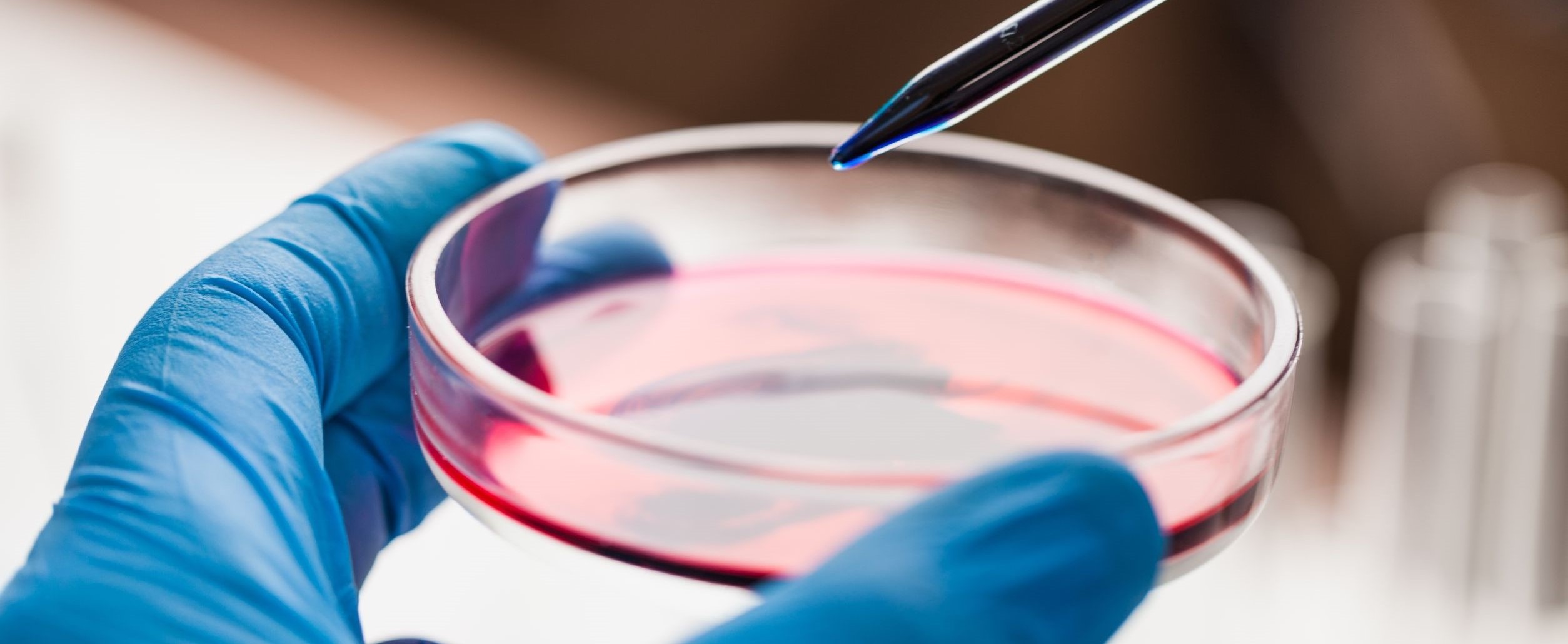 The Importance of Eliminating Contaminants in Cell Cultures